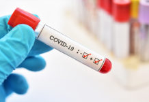 Wetangula sisters FINAL covid-19 test results are out