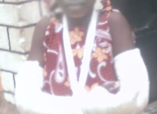 Merciless Mercy on the run after breaking niece’s hands, slicing her thighs