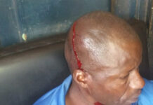 Hired Machete wielding goons unleash terror at a Bukembe East funeral