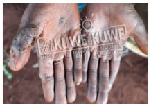 NDIVISI; Parents abandon 8 jigger infested children