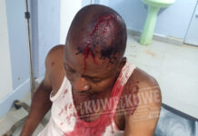 BUNGOMA Police on the spot for beating a man senseless in the name of rescuing him