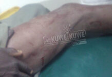 Wetangula’s shamba-boy shot as Police attempt to rescue notorious thieves from mob-justice