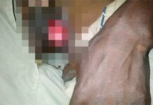 Protected: Shock as daughter in-law bites off father in-law’s manhood